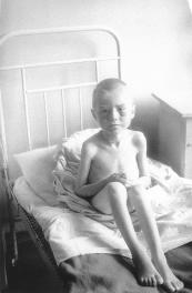 Girl Suffering from Dystrophy in the Hospital. Photo by N.Khandogin. Spring -summer, 1942.